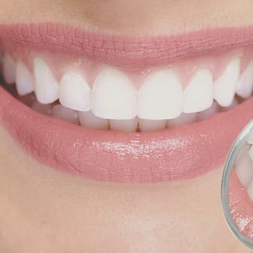 All Smiles Family Dental Care