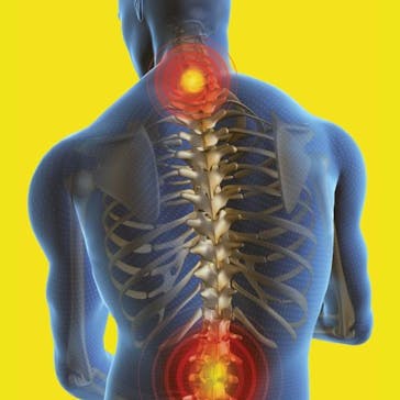 Precision Physiotherapy Brentwood