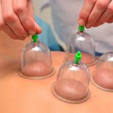 Ms Quan's Massage & Dry Needling & Cupping